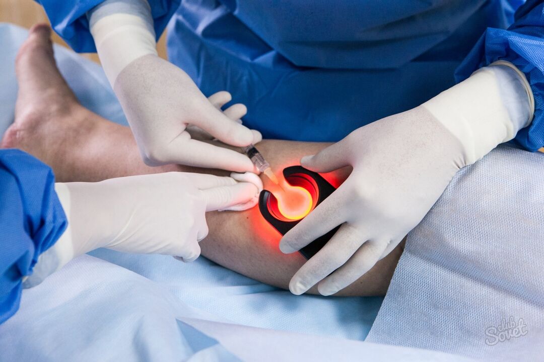 Varicose veins on the diagnostics of the legs