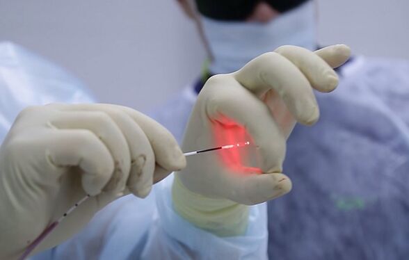 Laser fiber