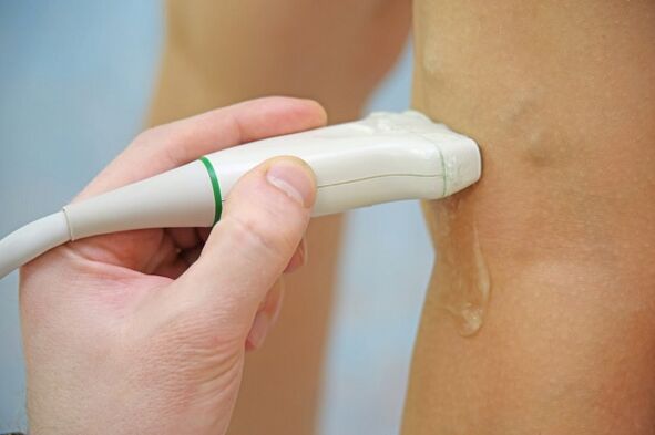 Ultrasound of the veins