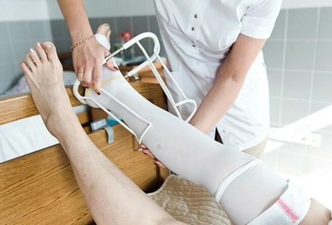 Postoperative period from surgery on the veins of the legs